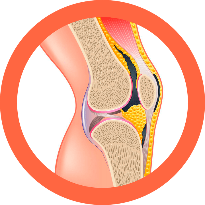 Hondroten stellt Gelenke und Muskeln wieder her